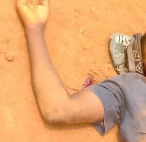 Photo agent Ebola assasiné a Butuhe-Beni