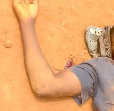 Photo agent Ebola assasiné a Butuhe-Beni